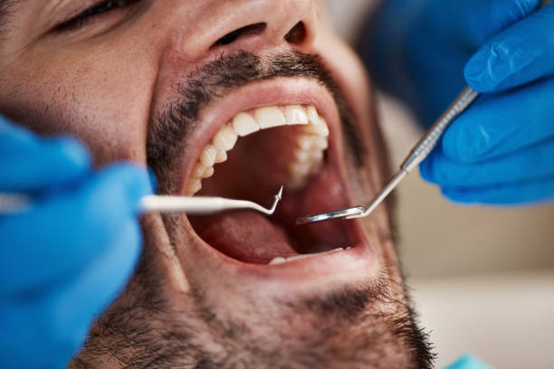 Best Urgent Tooth Repair  in Cleveland, NC