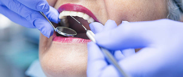 Best Cracked Tooth Emergency Dentist  in Cleveland, NC